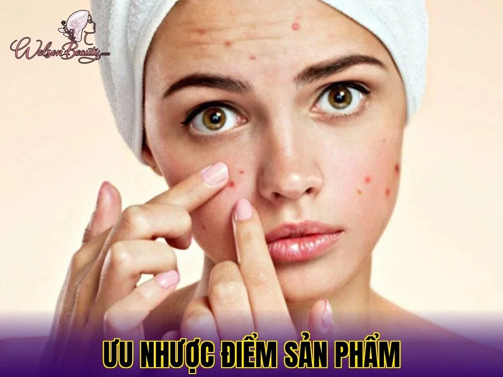 ưu nhược điểm sản phẩm
