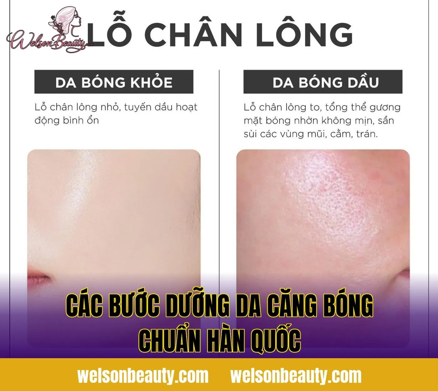 các bước dưỡng da căng bóng chuẩn hàn quốc