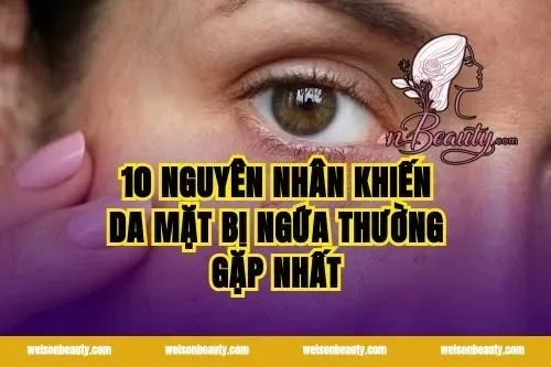 10 nguyên nhân khiến da mặt bị ngứa thường gặp nhất