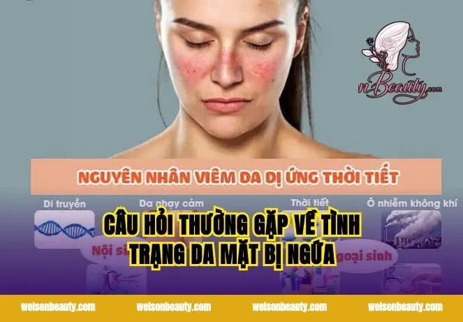 Câu hỏi thường gặp về tình trạng da mặt bị ngứa